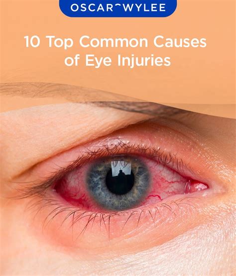 What can cause permanent eye damage?