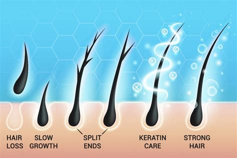 What can permanently damage hair follicles?