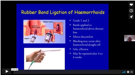 What can you eat after rubber band ligation?