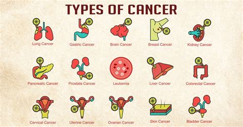 What cancer has no stages?