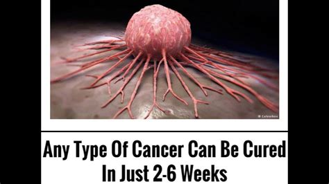 What cancers can be fully cured?