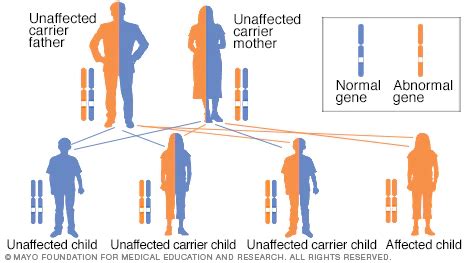 What causes Down syndrome dominant or recessive?