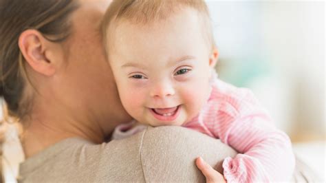 What causes Down syndrome in a baby?