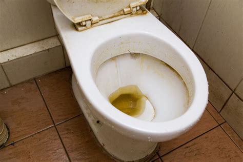 What causes brown stains in toilet bowl?
