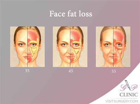 What causes face fat?