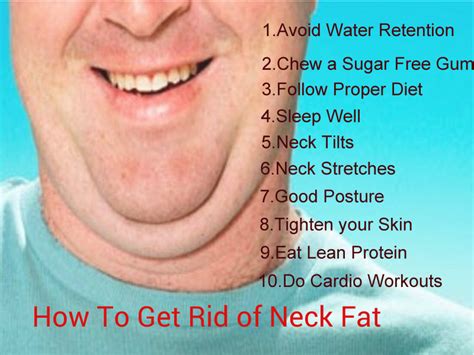 What causes fat necks?
