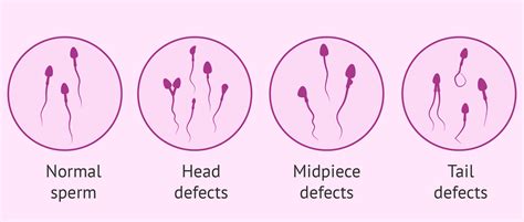 What causes head defects in sperm?