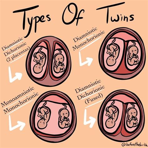 What causes twins?