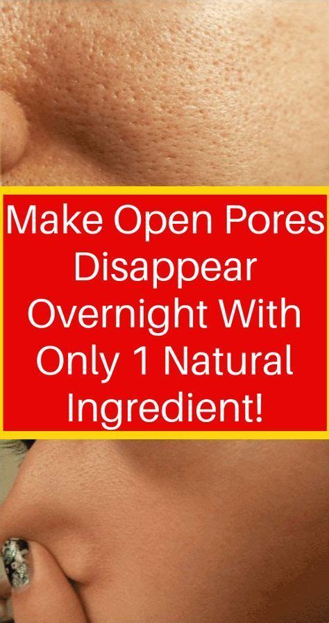 What clears pores naturally?