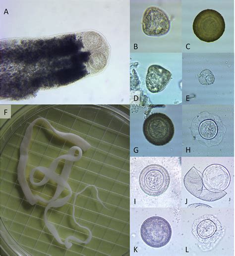 What color are tapeworm eggs?