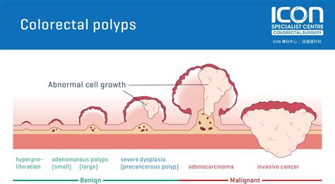 What color is blood from polyps?