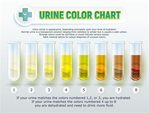 What color is dilute urine?