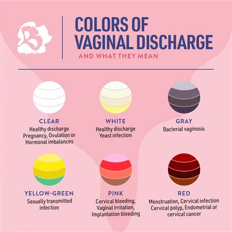 What color is infection discharge?