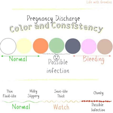 What color is pregnancy discharge?