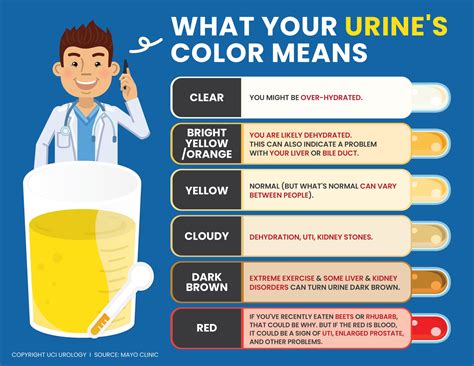 What color of urine is not good?