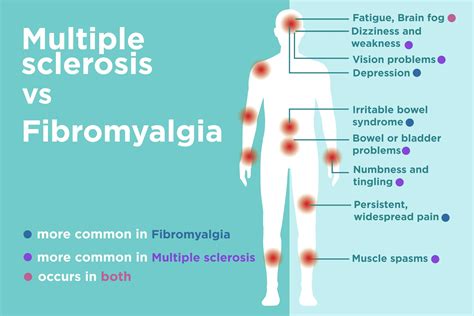 What could be misdiagnosed as MS?