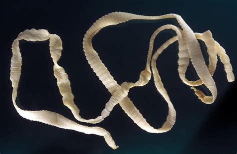 What country has the most tapeworms?