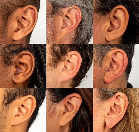 What culture has attached earlobes?