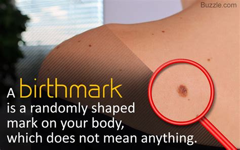 What did the birthmark symbolize?
