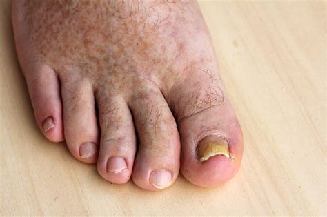 What diseases can your feet reveal?