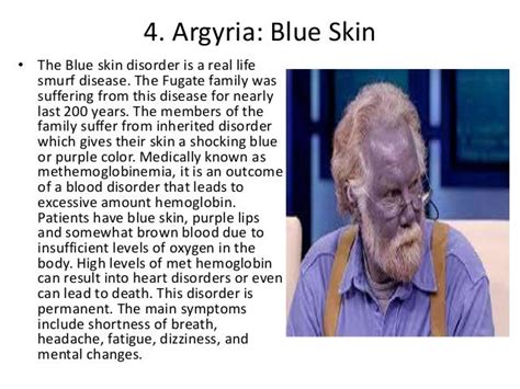 What diseases make skin blue?