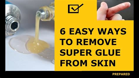 What dissolves glue residue on skin?