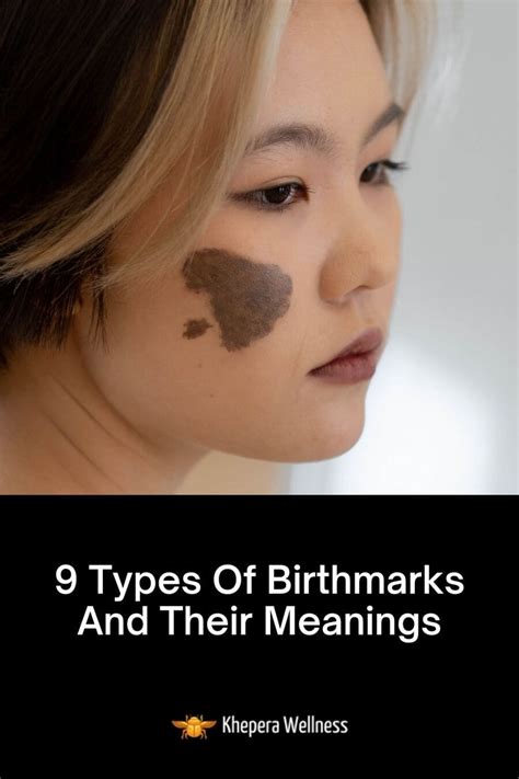 What do birthmarks symbolize?