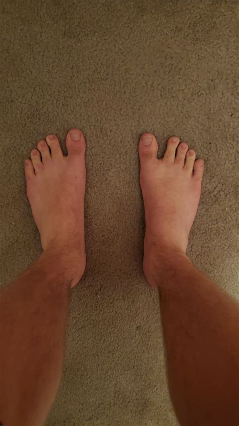 What do feet look like if you never wear shoes?