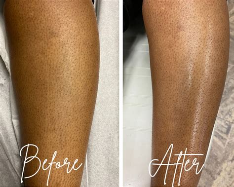 What do legs look like immediately after waxing?