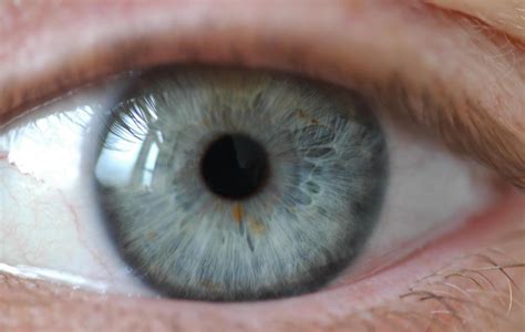 What do normal pupils look like?