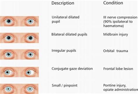 What do small pupils mean emotions?