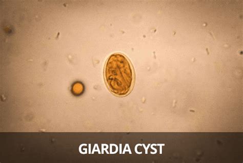 What does Giardia poop look like?