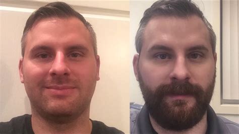What does a 2 month beard look like?