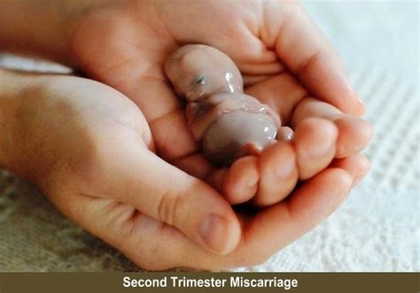 What does a 2nd trimester miscarriage feel like?