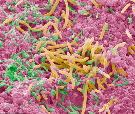 What does a bacterial tongue look like?