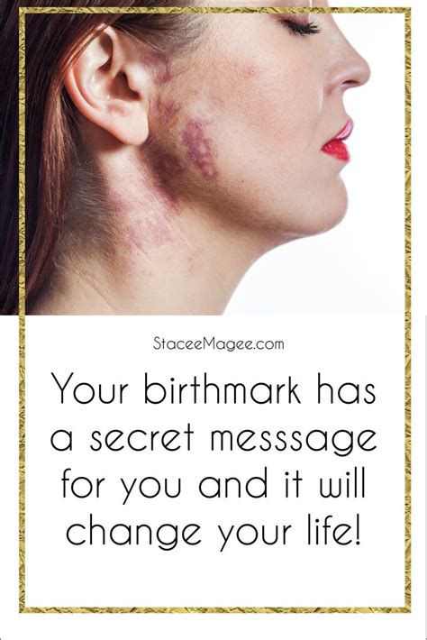 What does a birthmark symbolize?