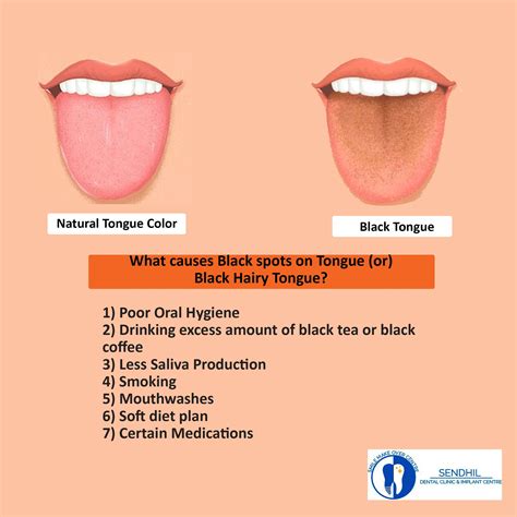 What does a brown spot in your mouth mean?