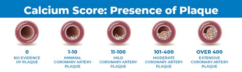 What does a calcium score of 1600 mean?