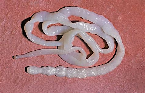 What does a dried up tapeworm look like?