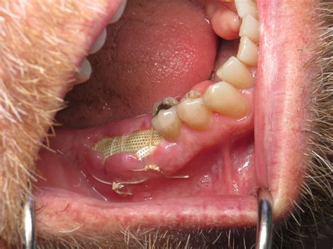 What does a healing gum hole look like?