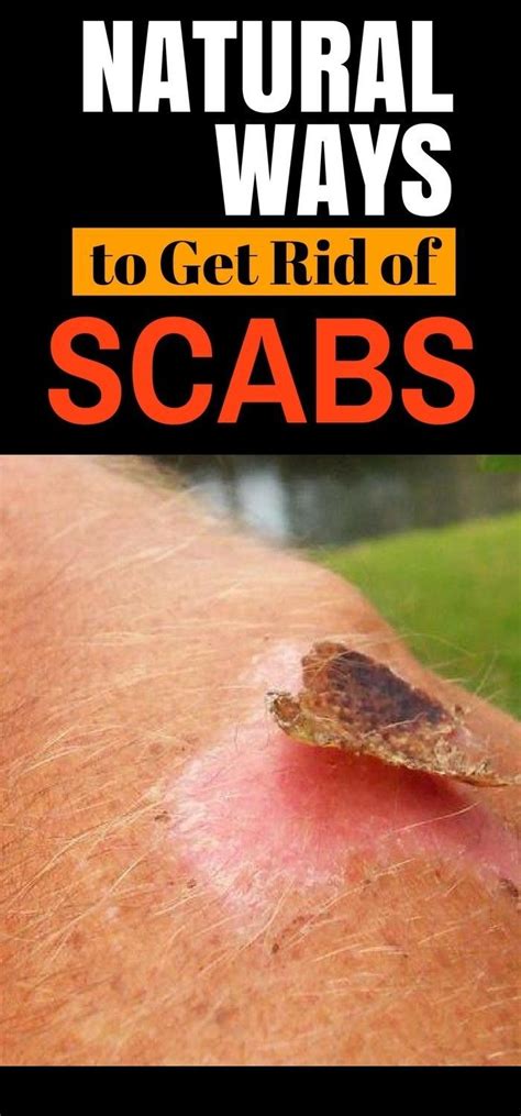 What does a healthy scab look like?