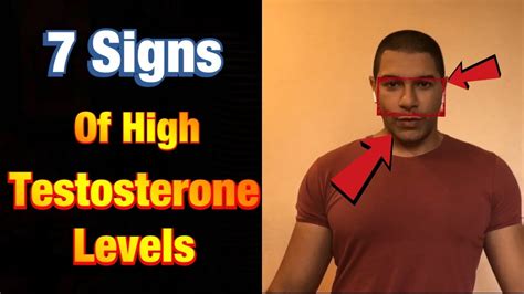 What does a high testosterone face look like?