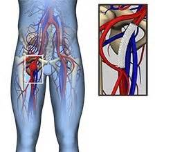 What does a leg aneurysm feel like?