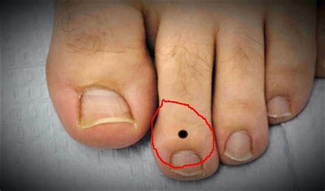 What does a long second toe indicate?