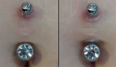 What does a piercing bump look like?