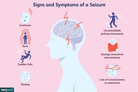 What does a seizure feel like?