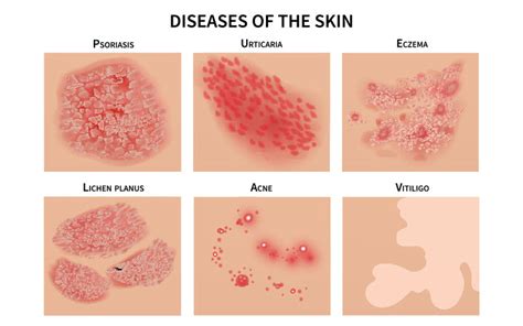 What does a skin virus look like?