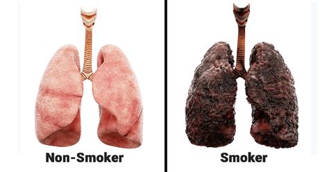 What does a smokers lung look like?