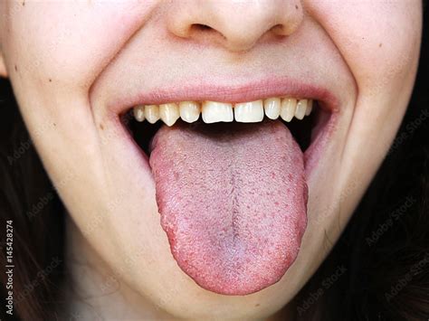 What does a unhealthy tongue look like?