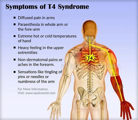 What does arm numbness feel like?